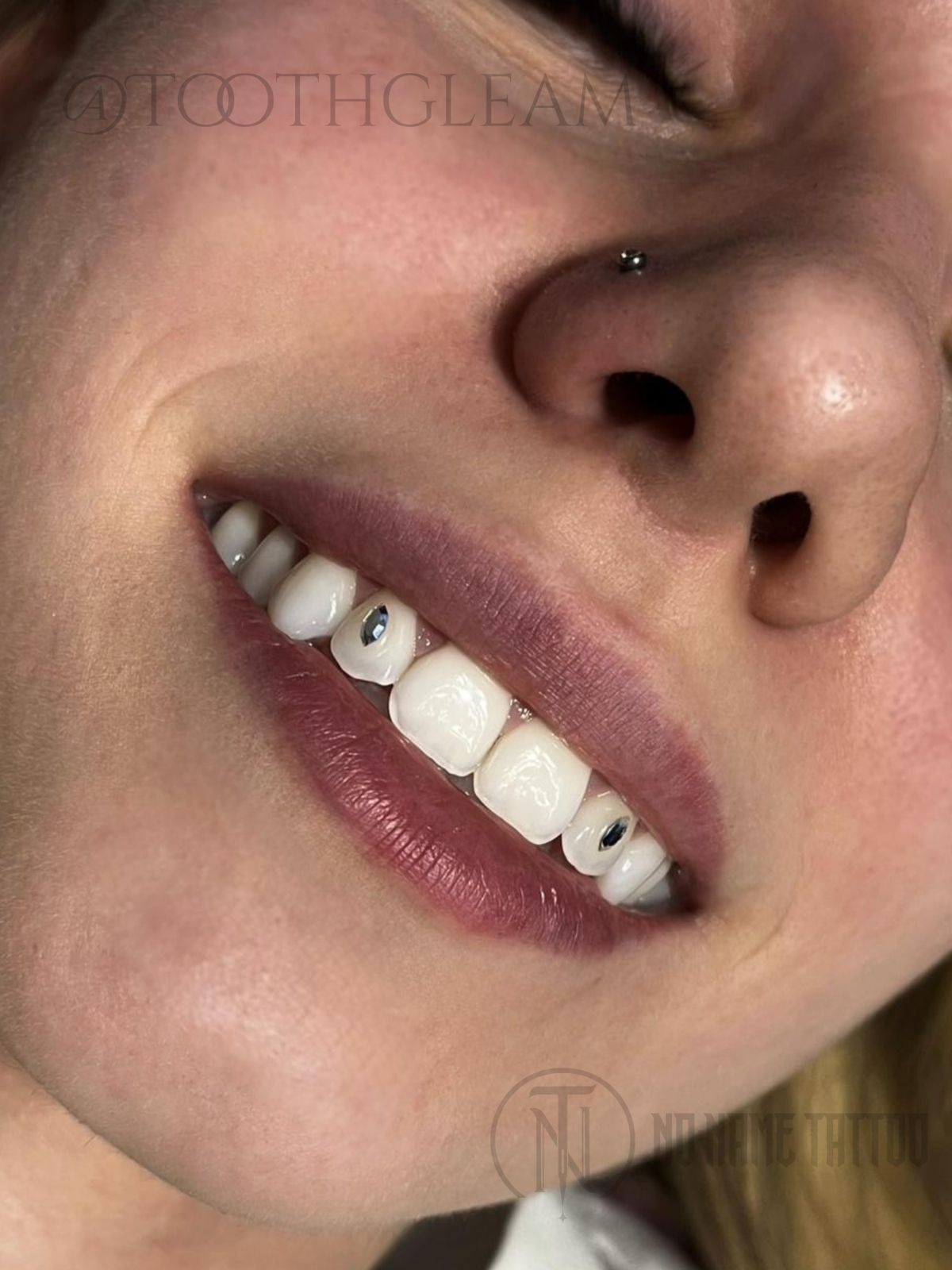 Tooth Gems Maja (1)