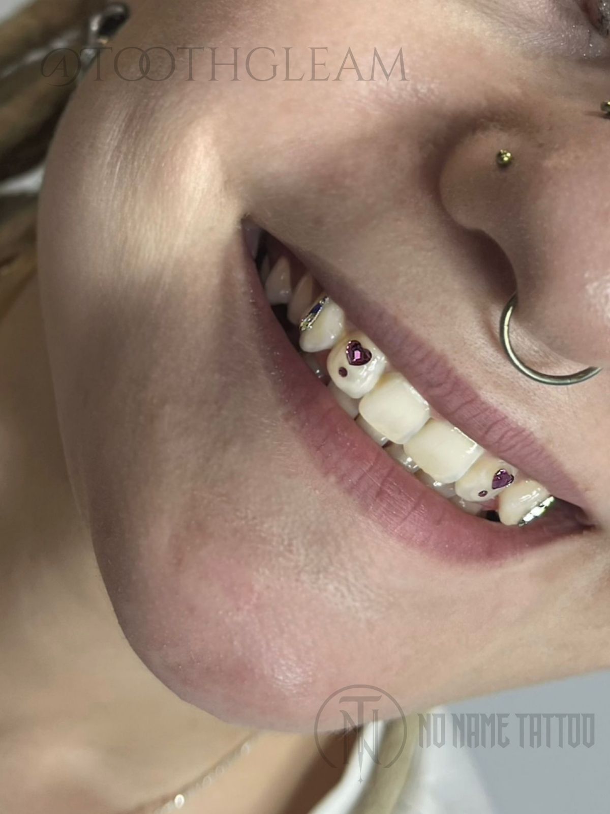 Tooth Gems Maja (2)