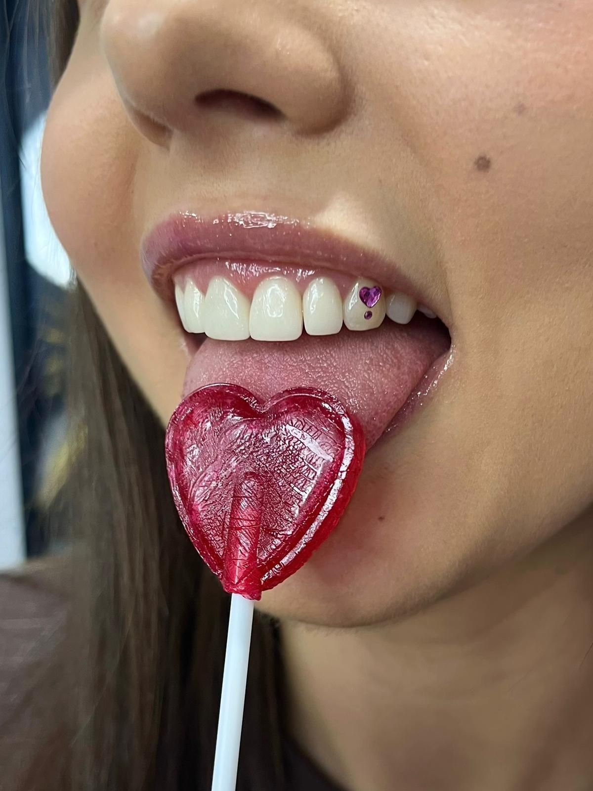 Tooth Gems Maja (3)