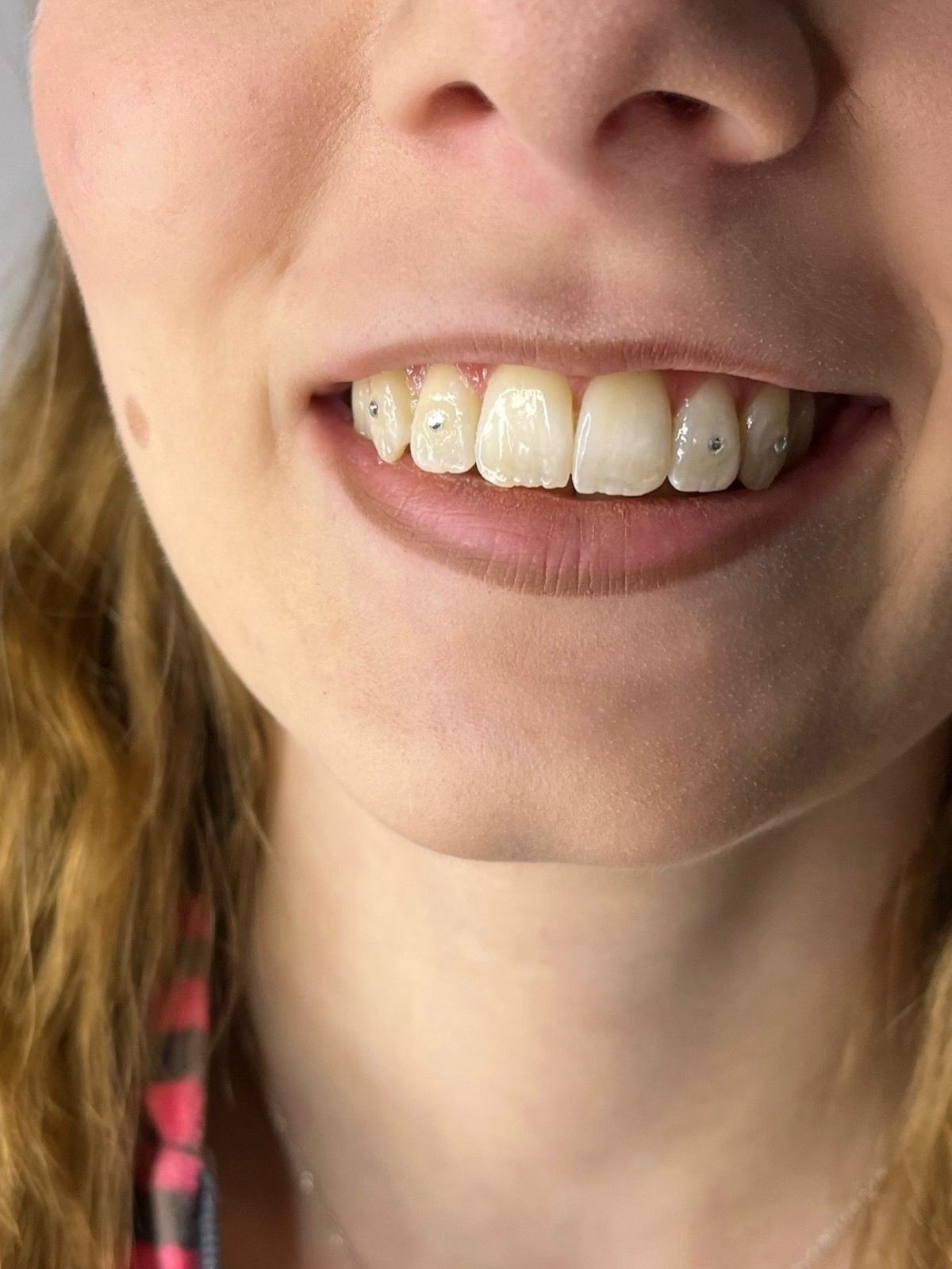Tooth Gems Maja (6)