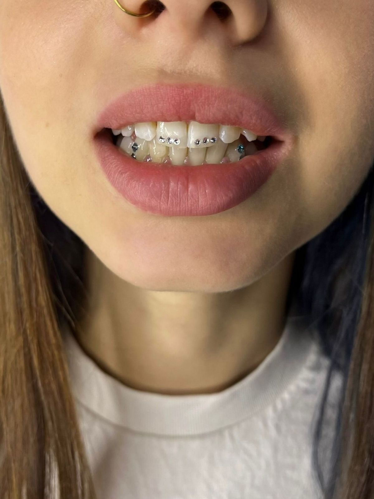 Tooth Gems Maja (7)