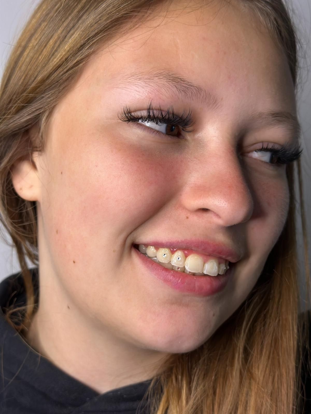 Tooth Gems Maja (8)