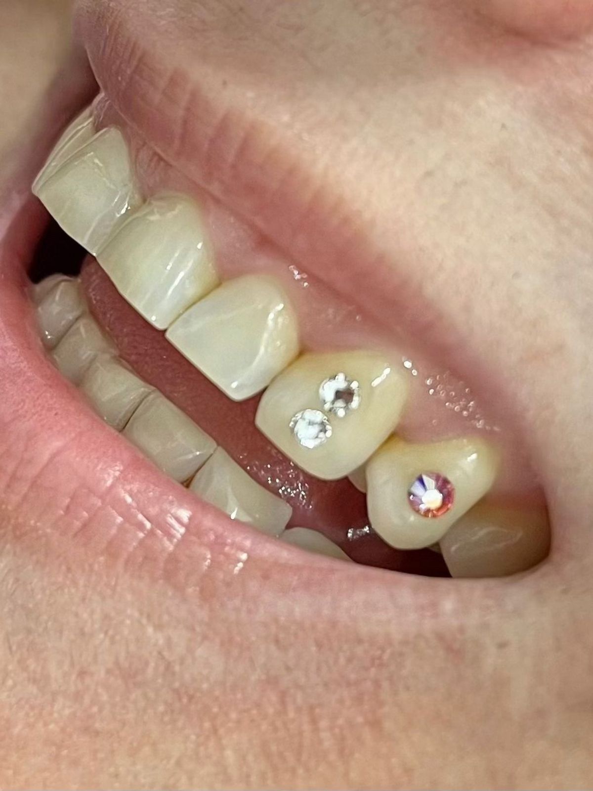 Tooth Gems Maja (9)